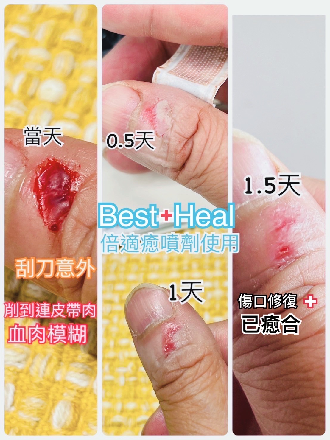日常割傷使用紀錄